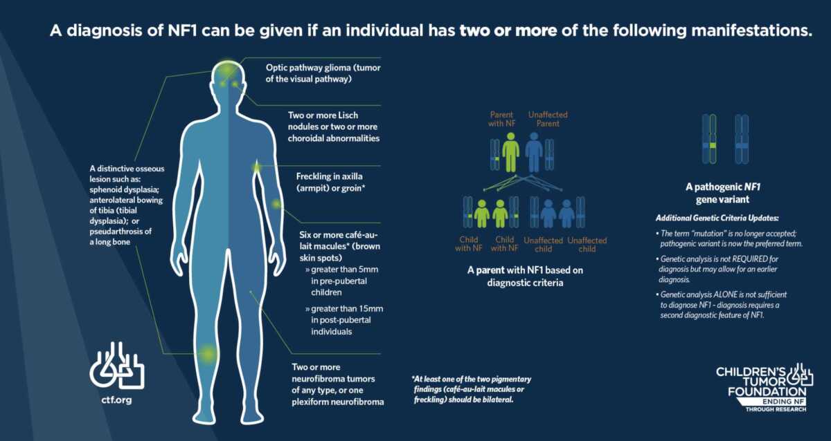 A diagram of a person with NF.